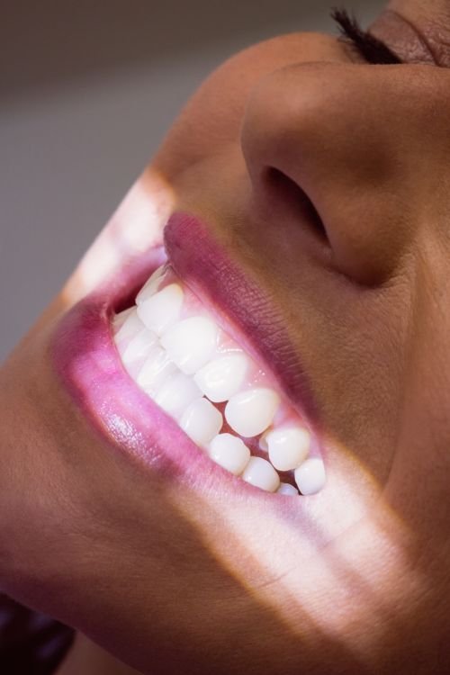 close up of female patient receiving a dental treatment at clinic